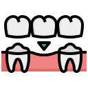 Dental Bridges
              