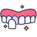 Veneers
              