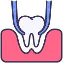 Tooth Extraction

              